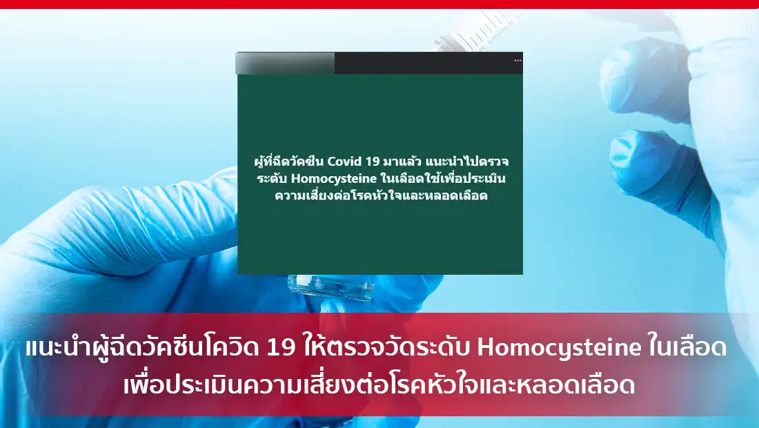 ระดับ Homocysteine ในเลือด