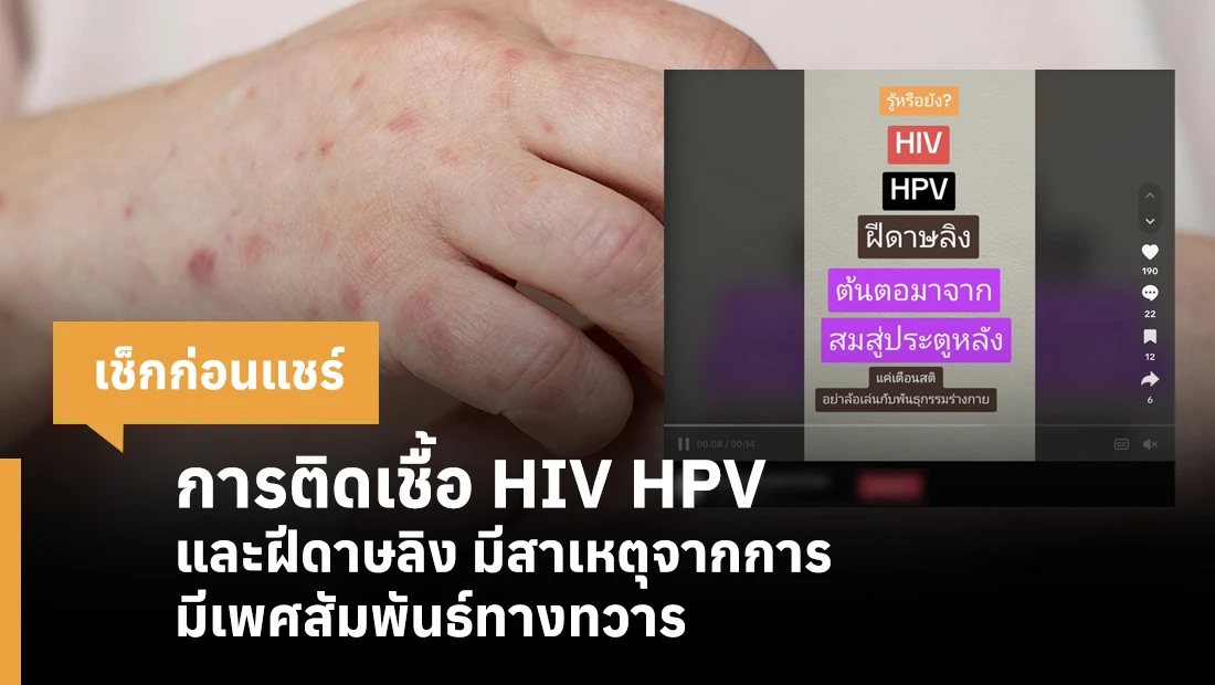 HIV HPV infection and smallpox are caused by anal sex.